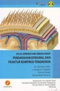 Atlas Operasi Ilmu Bedah Saraf; Pendarahan Epidural & Fraktur Kompresi Tengkorak