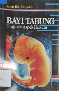 Image of Bayi Tabung Tinjaun Aspek Hukum