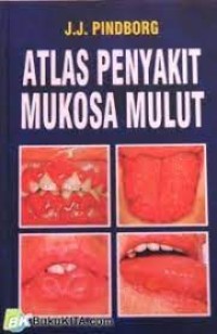 Atlas Penyakit Mukosa Mulut Image of Atlas Penyakit Mukosa Mulut